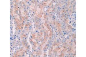IHC-P analysis of Mouse Kidney Tissue, with DAB staining. (CA7 抗体  (AA 58-217))