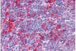 Human Tonsil: Formalin-Fixed, Paraffin-Embedded (FFPE) (KLHL25 抗体  (Internal Region))