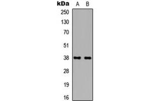 Western blot analysis of TBP expression in HEK293T (A), NIH3T3 (B) whole cell lysates. (TBP 抗体  (Center))
