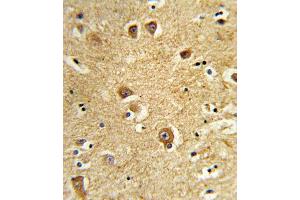 Formalin-fixed and paraffin-embedded human brain tissue reacted with SLC22A6 Antibody , which was peroxidase-conjugated to the secondary antibody, followed by DAB staining.