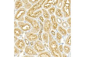 Immunohistochemistry of paraffin-embedded rat kidney using SLC12 Rabbit pAb (ABIN6131136, ABIN6147843, ABIN6147844 and ABIN6215366) at dilution of 1:50 (40x lens). (SLC12A2 抗体  (AA 120-280))