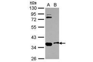 Image no. 1 for anti-Osteopetrosis Associated Transmembrane Protein 1 (OSTM1) (AA 1-334) antibody (ABIN1499928) (OSTM1 抗体  (AA 1-334))