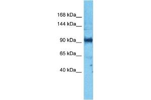 Host:  Rabbit  Target Name:  PARD3  Sample Type:  PANC1 Whole Cell lysates  Antibody Dilution:  1. (PARD3 抗体  (N-Term))