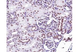 Immunohistochemistry (IHC) image for anti-Tumor Protein P53 (TP53) (pSer9) antibody (ABIN6255556)