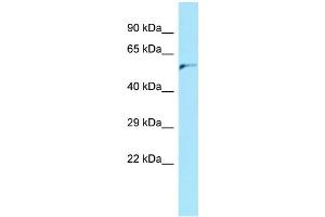 WB Suggested Anti-AP4M1 Antibody Titration: 1.