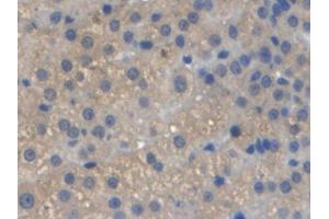 Immunohistochemistry (IHC) image for anti-Orosomucoid 1 (ORM1) (AA 20-186) antibody (ABIN7428032)