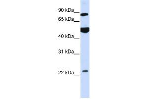 WB Suggested Anti-GCS1 Antibody Titration:  0. (GCS1 抗体  (N-Term))