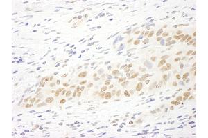 anti-Microtubule Associated serine/threonine Kinase-Like (MASTL) (AA 550-600) antibody