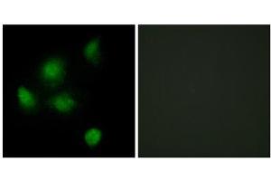 Immunofluorescence analysis of HeLa cells, using SIN3B antibody.