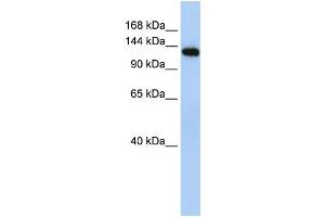 Western Blotting (WB) image for anti-Myosin Binding Protein C, Fast Type (MYBPC2) antibody (ABIN2458630) (MYBPC2 抗体)