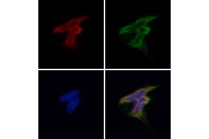 ABIN6257207 and ABIN6275954 staining Hela by IF/ICC. (G Protein-Coupled Receptor 119 抗体  (Internal Region))