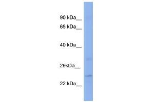 WB Suggested Anti-KLF16 Antibody Titration:  0. (KLF16 抗体  (Middle Region))