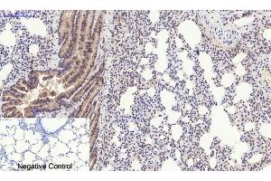 Immunohistochemical analysis of paraffin-embedded rat lung tissue. (PERK 抗体  (pThr981))