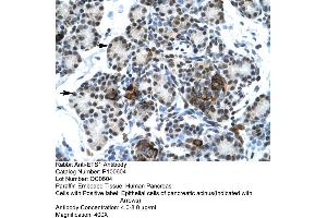 Human Pancrease (ETS1 抗体  (N-Term))