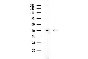 anti-Coiled-Coil Domain Containing 44 (CCDC44) (Internal Region) antibody