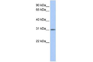 WB Suggested Anti-ODF3L1 Antibody Titration: 0. (ODF3L1 抗体  (N-Term))
