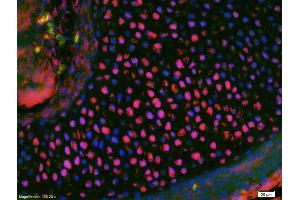 Formalin-fixed and paraffin-embedded rat brain labeled with Anti-Phospho-MEF2A (Ser408) Polyclonal Antibody, Unconjugated (ABIN743783) 1:200, overnight at 4°C, The secondary antibody was Goat Anti-Rabbit IgG, Cy3 conjugated used at 1:200 dilution for 40 minutes at 37°C.