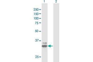 Western Blot analysis of PPT1 expression in transfected 293T cell line by PPT1 MaxPab polyclonal antibody. (PPT1 抗体  (AA 1-306))
