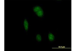 Immunofluorescence of purified MaxPab antibody to FTSJ1 on HeLa cell. (FTSJ1 抗体  (AA 1-329))