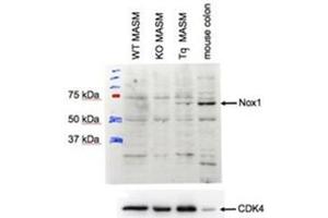 AP31401PU-N NOX1 antibody staining of MASM lysate at 1 µg/ml (35 µg protein in RIPA buffer). (NOX1 抗体  (Internal Region))