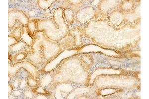 ABIN6265674 and ABIN6266664 at 1/100 staining human normal kidney tissue by IHC-P. (TOP2B 抗体  (N-Term))