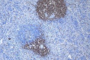 IHC analysis of CD3 epsilon/Cd3e using anti-CD3 epsilon/Cd3e antibody (ABIN7600665).