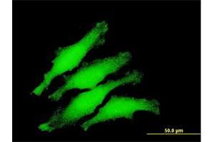 Immunofluorescence of purified MaxPab antibody to ZNF397 on HeLa cell. (ZNF397 抗体  (AA 1-275))