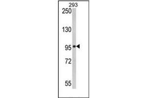Image no. 1 for anti-DEAD (Asp-Glu-Ala-Asp) Box Polypeptide 58 (DDX58) (AA 592-622) antibody (ABIN357195) (DDX58 抗体  (AA 592-622))