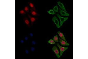 ABIN6255562 and ABIN6267432 staining HepG2 cells(4h of LPS treatment) by IF/ICC.