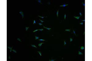 Immunofluorescence staining of SH-SY5Y cells with ABIN7165099-IF at 1:100, counter-stained with DAPI.
