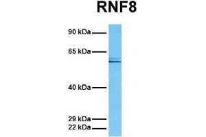 Host:  Rabbit  Target Name:  RNF8  Sample Tissue:  Human MCF7  Antibody Dilution:  1. (RNF8 抗体  (C-Term))