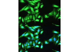 Immunofluorescence analysis of U2OS cells using STAT1 antibody. (STAT1 抗体  (AA 650-750))