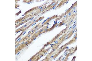 Immunohistochemistry of paraffin-embedded mouse heart using IKKε Rabbit mAb (ABIN7267875) at dilution of 1:100 (40x lens). (IKKi/IKKe 抗体)