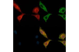 anti-EPH Receptor B1/2 (EPHB1/2) (pTyr594), (pTyr604) antibody
