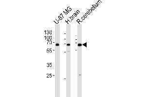 Western blot analysis of lysates from U-87 MG cell line , human brain and rat cerebellum tissue lysate(from left to right), using Mouse Camkk2 Antibody at 1:1000 at each lane. (CAMKK2 抗体  (N-Term))