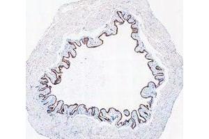 IHC analysis of Cytokeratin 20/Krt20 using anti-Cytokeratin 20/Krt20 antibody (ABIN7601133). (KRT20 抗体  (AA 29-431))