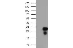 Western Blotting (WB) image for anti-Regulator of G-Protein Signaling 16 (RGS16) antibody (ABIN1500691) (RGS16 抗体)