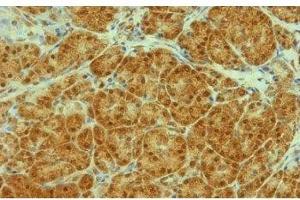 Image no. 3 for anti-Transportin 1 (TNPO1) antibody (ABIN108619) (Transportin 1 抗体)