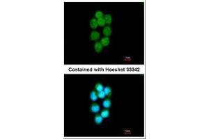 ICC/IF Image Immunofluorescence analysis of methanol-fixed A431, using TDP1, antibody at 1:200 dilution. (TDP1 抗体)