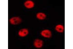 ABIN6267567 staining HepG2 by IF/ICC.