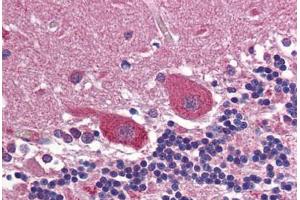 Human Brain, Cerebellum: Formalin-Fixed, Paraffin-Embedded (FFPE) (Huntingtin 抗体  (AA 2703-2911))