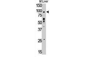 Western blot analysis of TLR6 polyclonal antibody  in mouse liver tissue lysate (35 ug/lane). (TLR6 抗体  (C-Term))