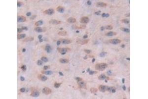 Used in DAB staining on fromalin fixed paraffin- embedded Kidney tissue (POMT1 抗体  (AA 318-513))