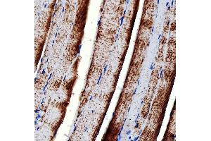 IHC analysis of RAB7/RAB7A using anti-RAB7/RAB7A antibody (ABIN7600597). (RAB7A 抗体  (AA 21-177))