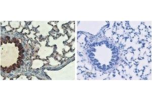 Expression of CFTR in rat lungs - Immunohistochemical staining of rat lungs sections using Anti-CFTR Antibody (ABIN7043096, ABIN7044127 and ABIN7044128) (left panel). (CFTR 抗体  (C-Term, Cytosolic))