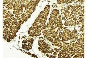 ABIN6269087 at 1/100 staining Mouse pancreas tissue by IHC-P. (HSP27 抗体  (Internal Region))