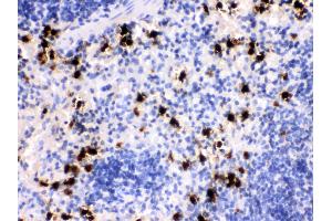 Anti- MRP8 Picoband antibody, IHC(P) IHC(P): Mouse Spleen Tissue (S100A8 抗体  (AA 2-89))