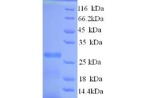 SDS-PAGE (SDS) image for Potassium Voltage-Gated Channel, Shal-Related Subfamily, Member 1 (Kcnd1) (AA 410-647), (Cytoplasmic Domain), (Cytosolic) protein (His tag) (ABIN4975469) (KCND1 Protein (AA 410-647, Cytoplasmic Domain, Cytosolic) (His tag))