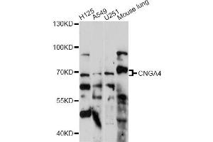 Western blot analysis of extracts of various cell lines, using CNGA4 antibody (ABIN6291314) at 1:1000 dilution. (CNGA4 抗体)