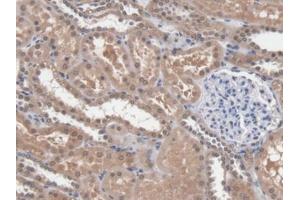 DAB staining on IHC-P; Samples: Human Kidney Tissue (DICER1 抗体  (AA 6-290))